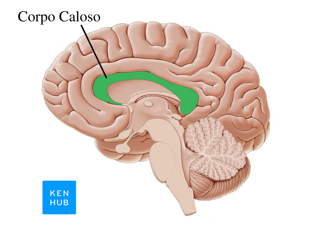 Imagem indicando a localização do corpo caloso no cérebro do músico